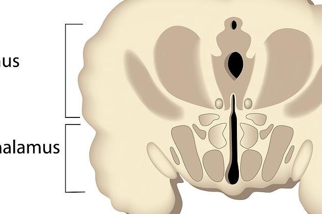 Nemoci hypothalamu 