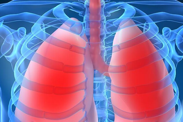 Pneumonie