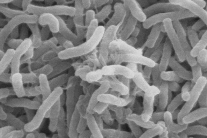Paratyfus