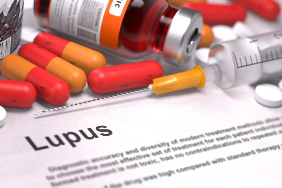 Systémový lupus erythematodes