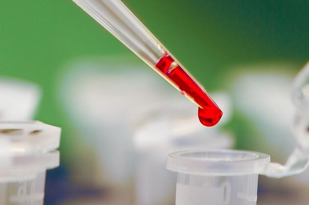 HDL cholesterol