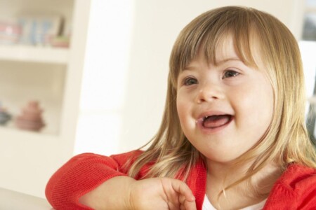 Downův syndrom