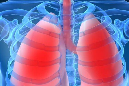 Pneumonie