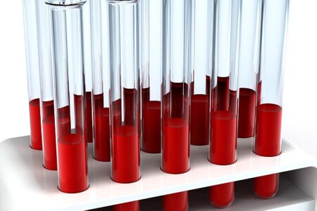 Ferritin