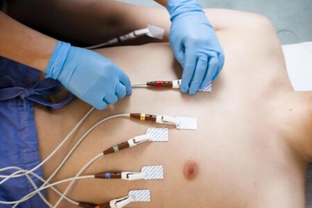 Elektrokardiogram