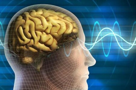 Neurologie