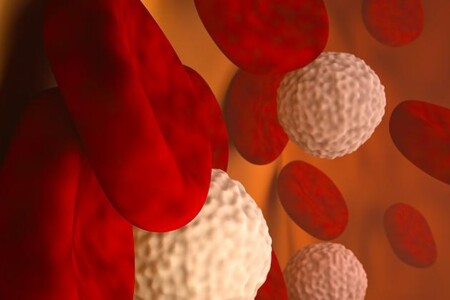 Leukemie